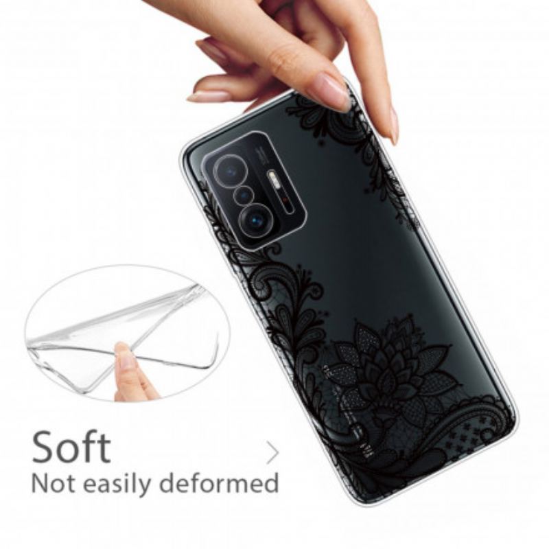 Coque Xiaomi 11T / 11T Pro Sublime Dentelle