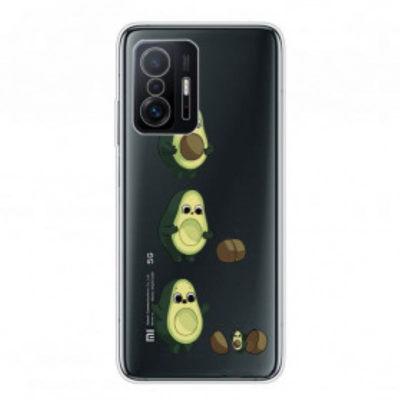 Coque Xiaomi 11T / 11T Pro La vie d'un Avocat