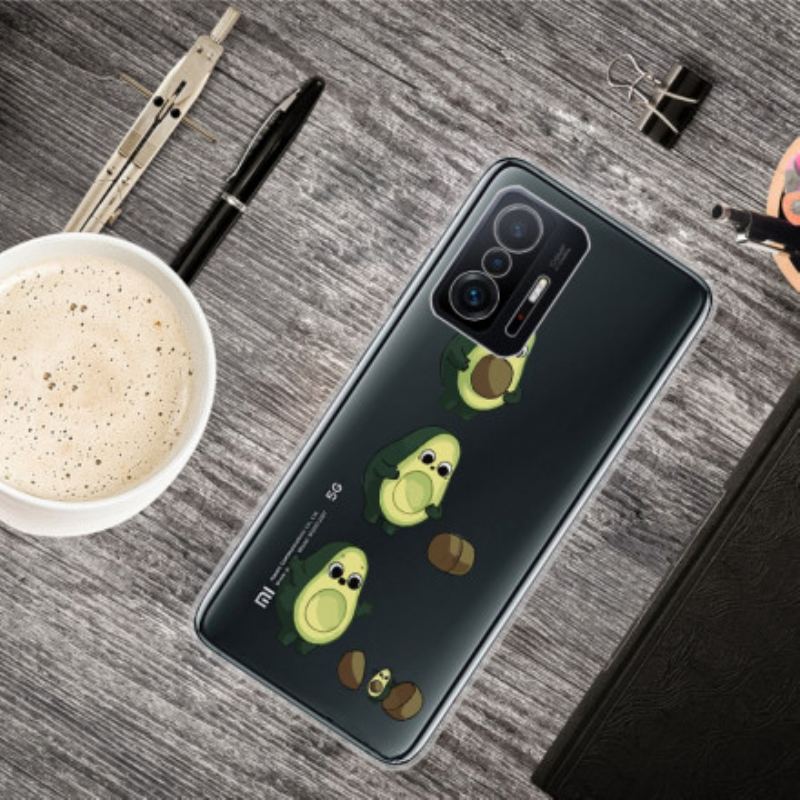 Coque Xiaomi 11T / 11T Pro La vie d'un Avocat