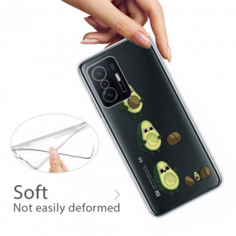 Coque Xiaomi 11T / 11T Pro La vie d'un Avocat