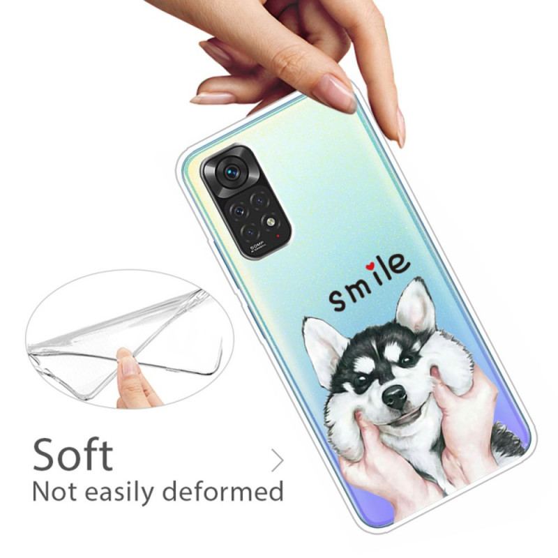 Coque Xiaomi Redmi Note 11 Pro /  Note 11 Pro 5G Smile Dog